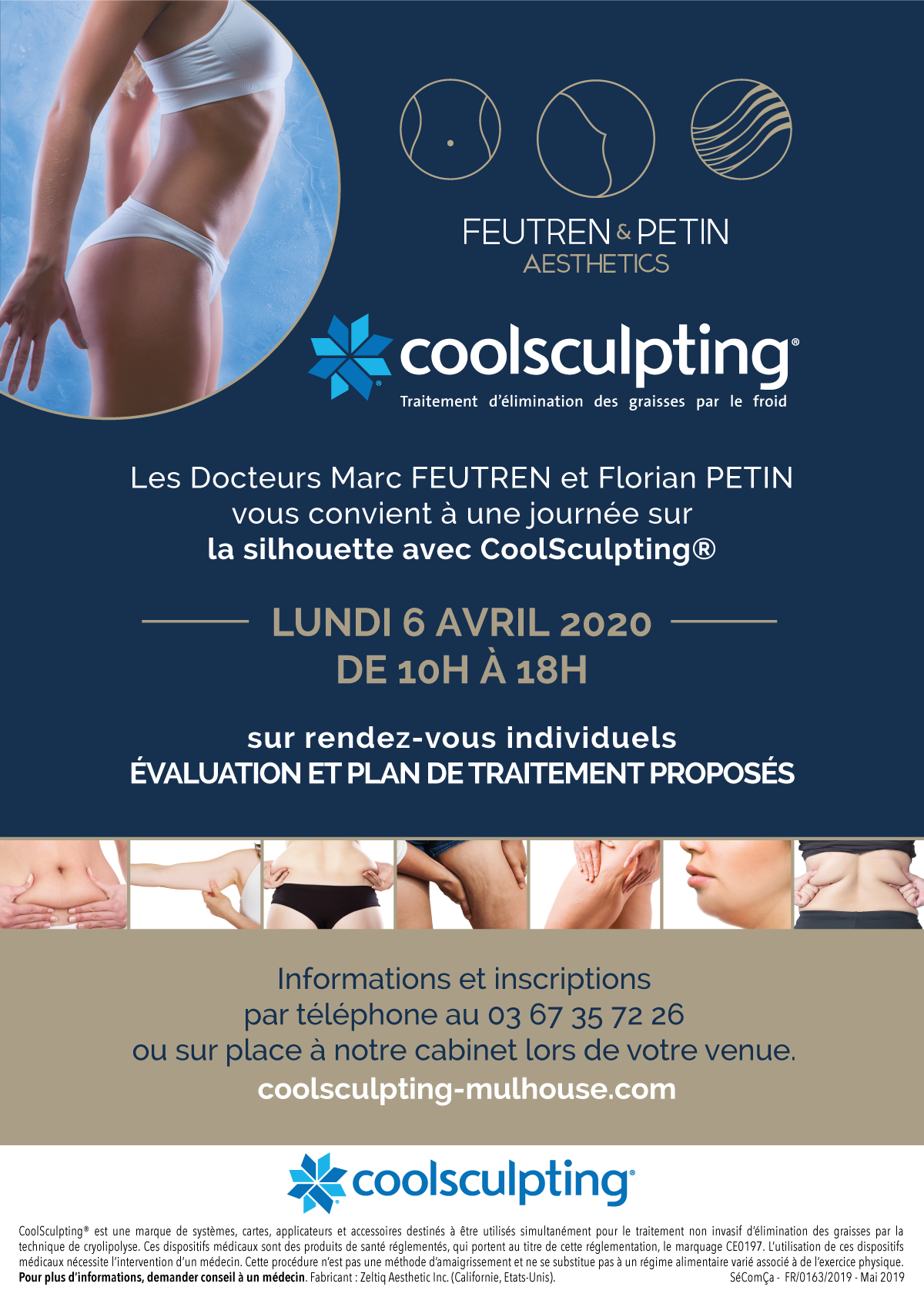Evenement Coolsculpting le 6 avril 2020 à Mulhouse Image
