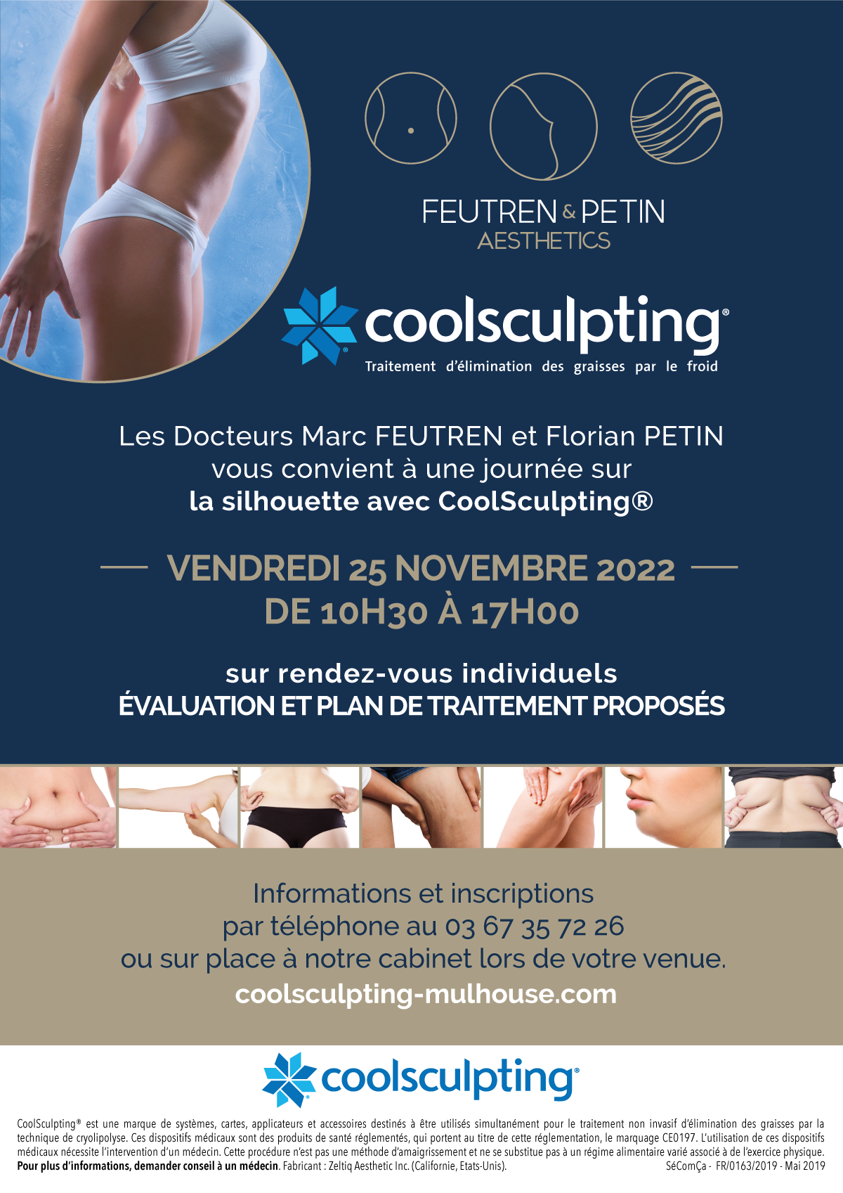 Coolsculpting event à Mulhouse