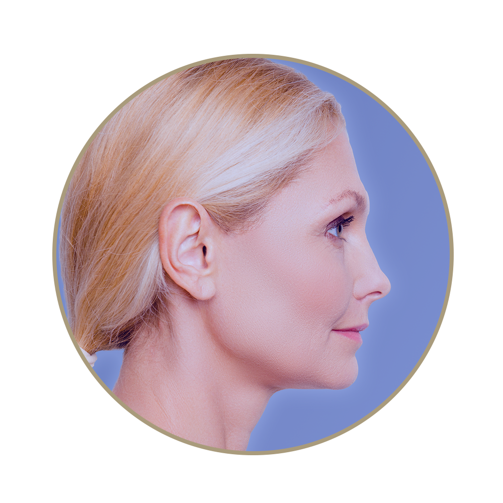 Hyaluronic Acid