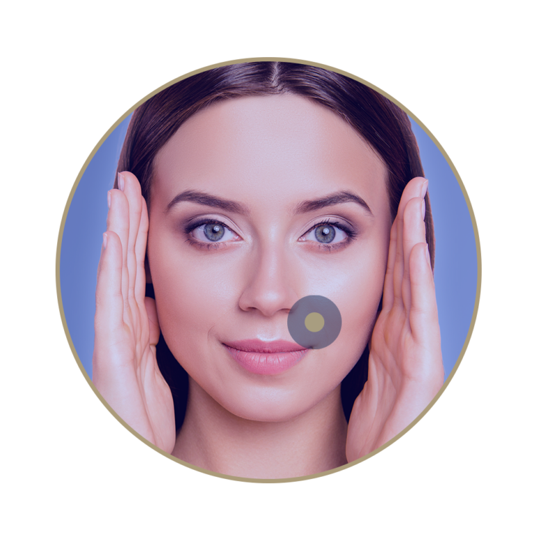 Nasolabial folds and marionette lines